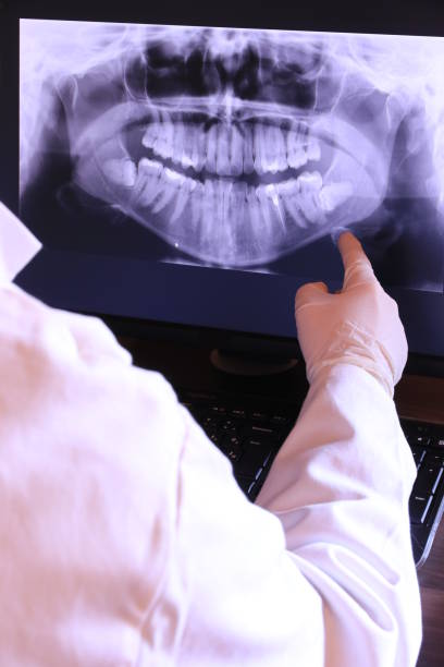 Best Emergency Tooth Extraction in Morenci, MI